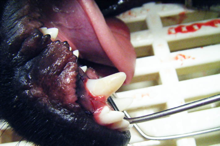 Unvollständige Schmelzbildung - Zahnversorgung