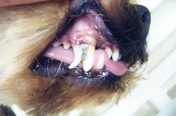Zahnstein bei überzähligen Zähnen